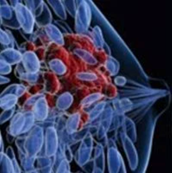 Triplet Combos Targeting ER, CDK4/6, and PIK3CA Inhibit Tumor Growth in ER+ Breast Cancer