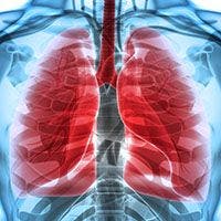 cfDNA Sequencing Shows Utility in Selecting KRAS G12C+ NSCLC for Sotorasib