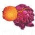 Immunotherapy: Personalized Treatment for Advanced Prostate Cancer