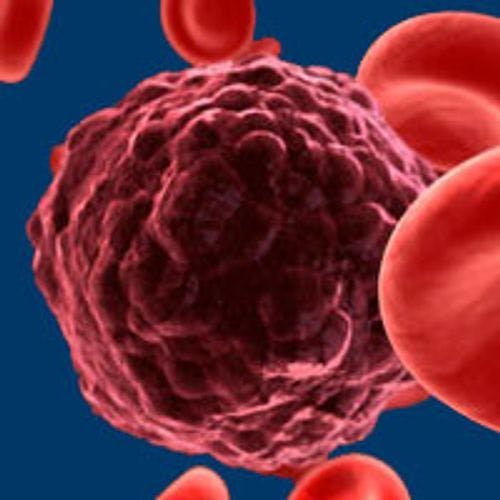 Hispanic Patients With Select Blood Cancers Have Worse Survival Outcomes