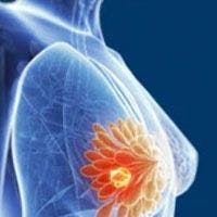 New Era for Targeting HER2 Beckons in Breast Cancer and Beyond