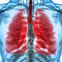 Pralsetinib Elicits Promising Activity in Advanced RET Fusion+ NSCLC 