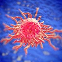 Toripalimab Produces Promising Clinical Activity in Metastatic Urothelial Cancer