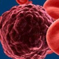 Dose-Adjusted Chemo Regimen Shows Efficacy in Burkitt Lymphoma, Regardless of Age or HIV Status