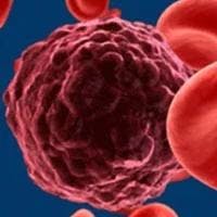 Clinical Collaboration Underway for Nirogacestat/Teclistamab Combo in Myeloma
