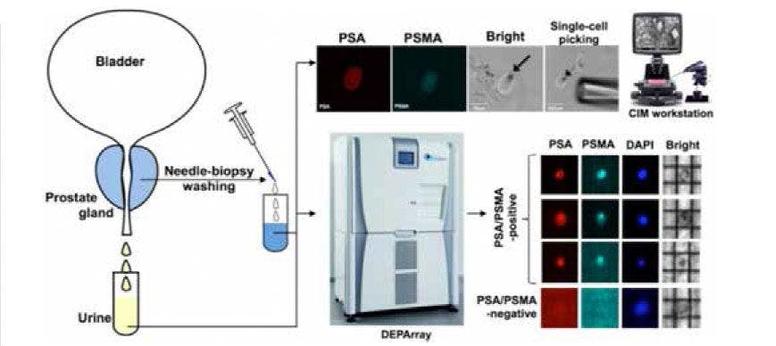 Figure 1. Single-cell isolation and characterization using CIM and DEPArray systems, respectively. Individual PSA/PSMA-positiveprostate epithelial cells have been isolated from urine or needle biopsy washes for downstream analysis using BioMark or AFM.The same approaches will be used to isolate epithelial cancer cells and the associated stromal fibroblasts from endocervicalbrushes and to isolate circulating rare cells from blood samples of cancer patients.