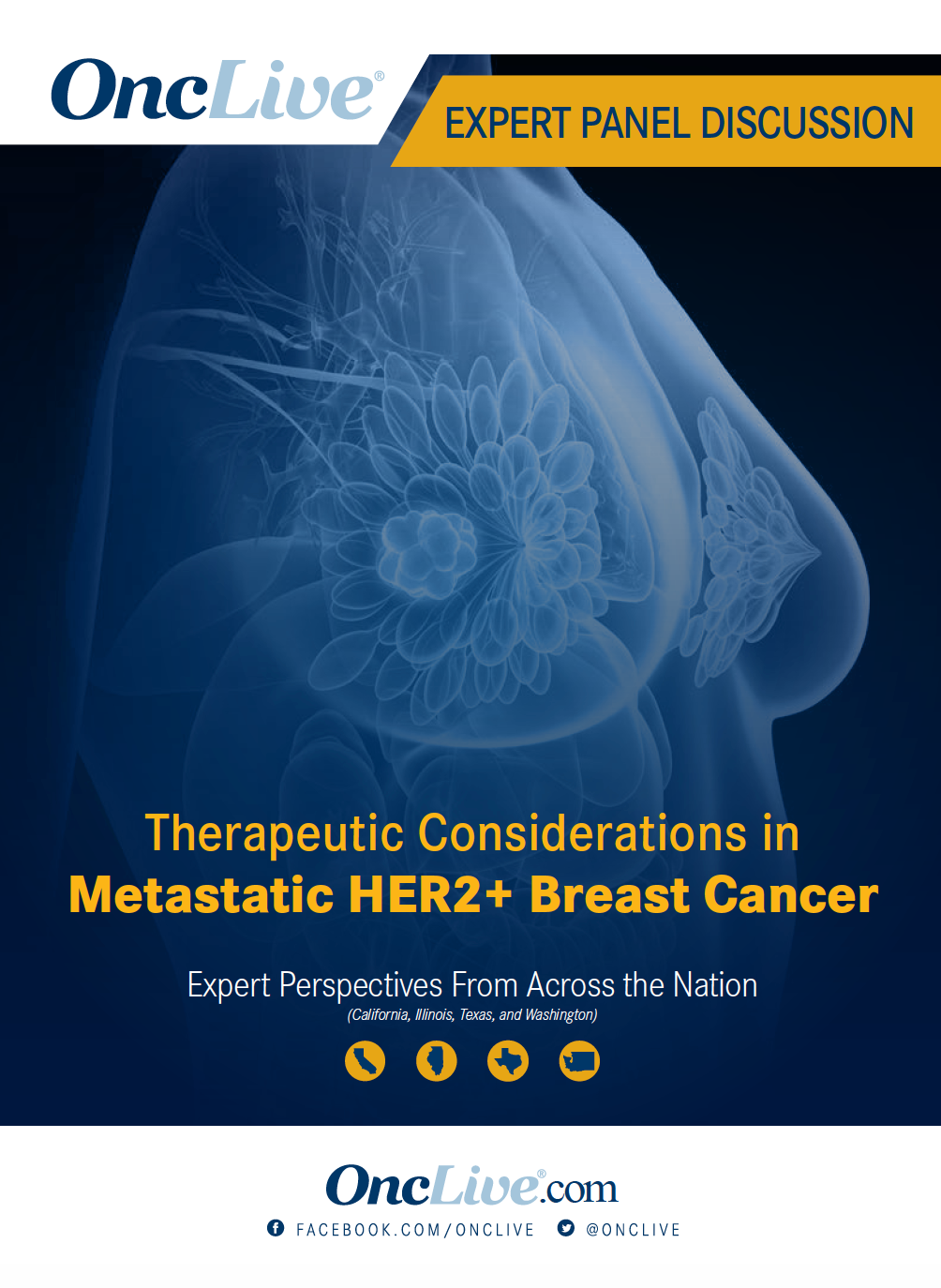 Therapeutic Considerations in Metastatic HER2+ Breast Cancer: Part 1