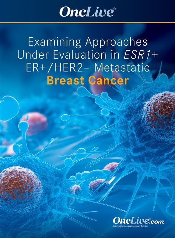 Examining Approaches Under Evaluation in ESR1+ ER+/HER2– Metastatic Breast Cancer