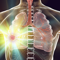 Atezolizumab led to an almost doubling in the rate of 2-year overall survival compared with vinorelbine or gemcitabine in patients with advanced platinum-ineligible non–small cell lung cancer.