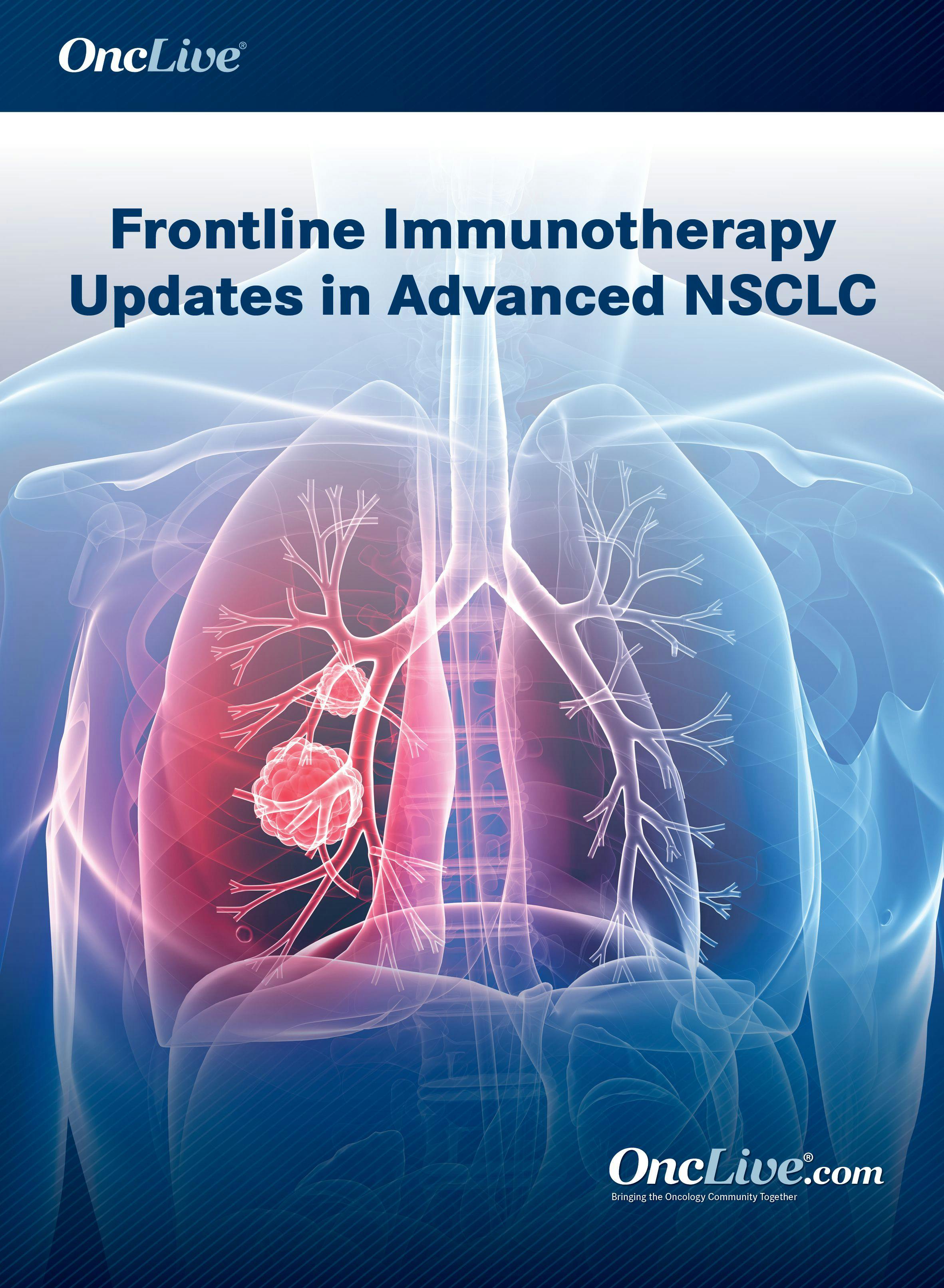 Frontline Immunotherapy Updates in Advanced NSCLC