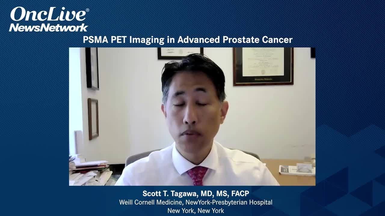 PSMA PET Imaging in Advanced Prostate Cancer