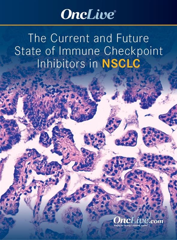 The Current and Future State of Immune Checkpoint Inhibitors in NSCLC