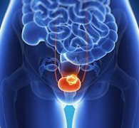 EU Panel Recommends Updated Label for Pembrolizumab in Select Locally Advanced or Metastatic Urothelial Cancer 