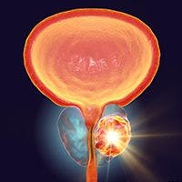 Prostate Cancer | Image Credit: © Dr_Microbe - stock.adobe.com