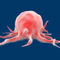 Tough Target: New Therapies for Cancer Pain Lagging